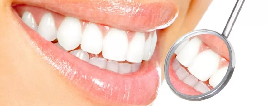 Diş Beyazlatma