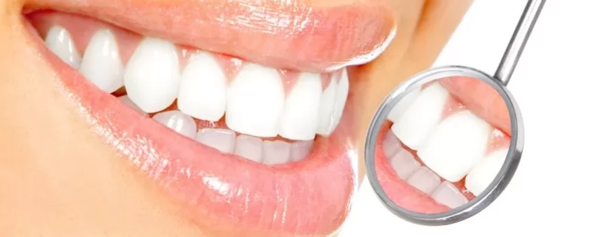 Diş Beyazlatma